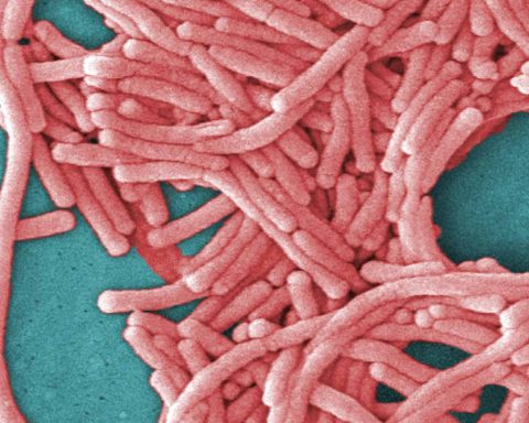 Legionnaires' Disease Outbreak Hits Toronto- What Residents Should Know
