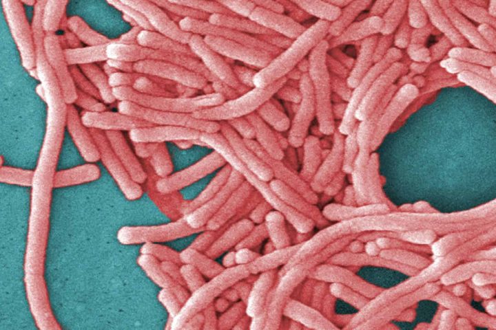 Legionnaires' Disease Outbreak Hits Toronto- What Residents Should Know