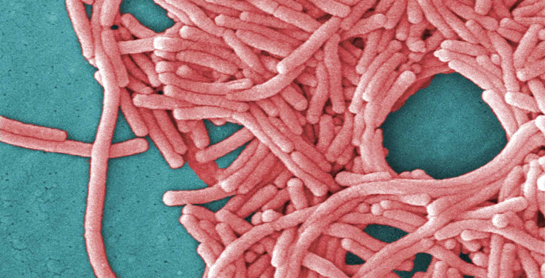 Legionnaires' Disease Outbreak Hits Toronto- What Residents Should Know